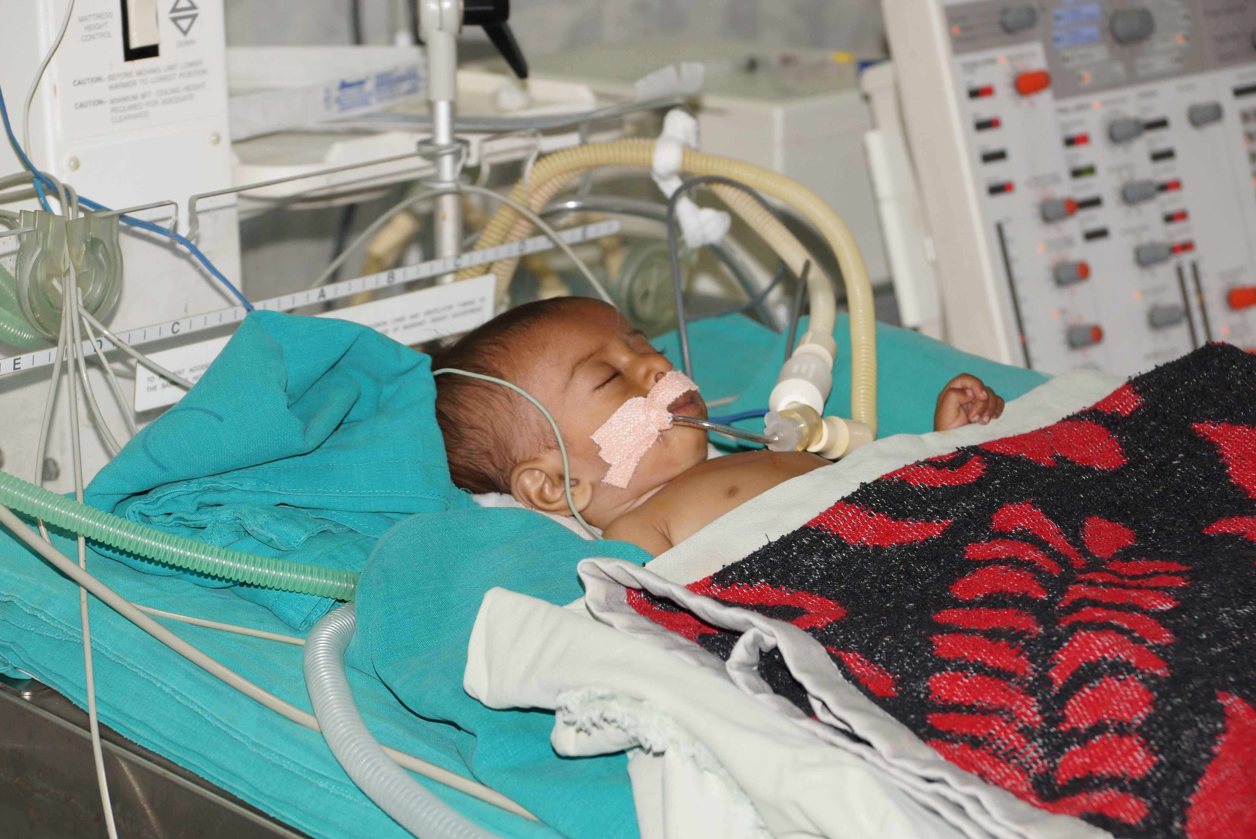 Cardiac Perfusion Technology at Sri Sathya Sai Institute of Higher Medical Sciences