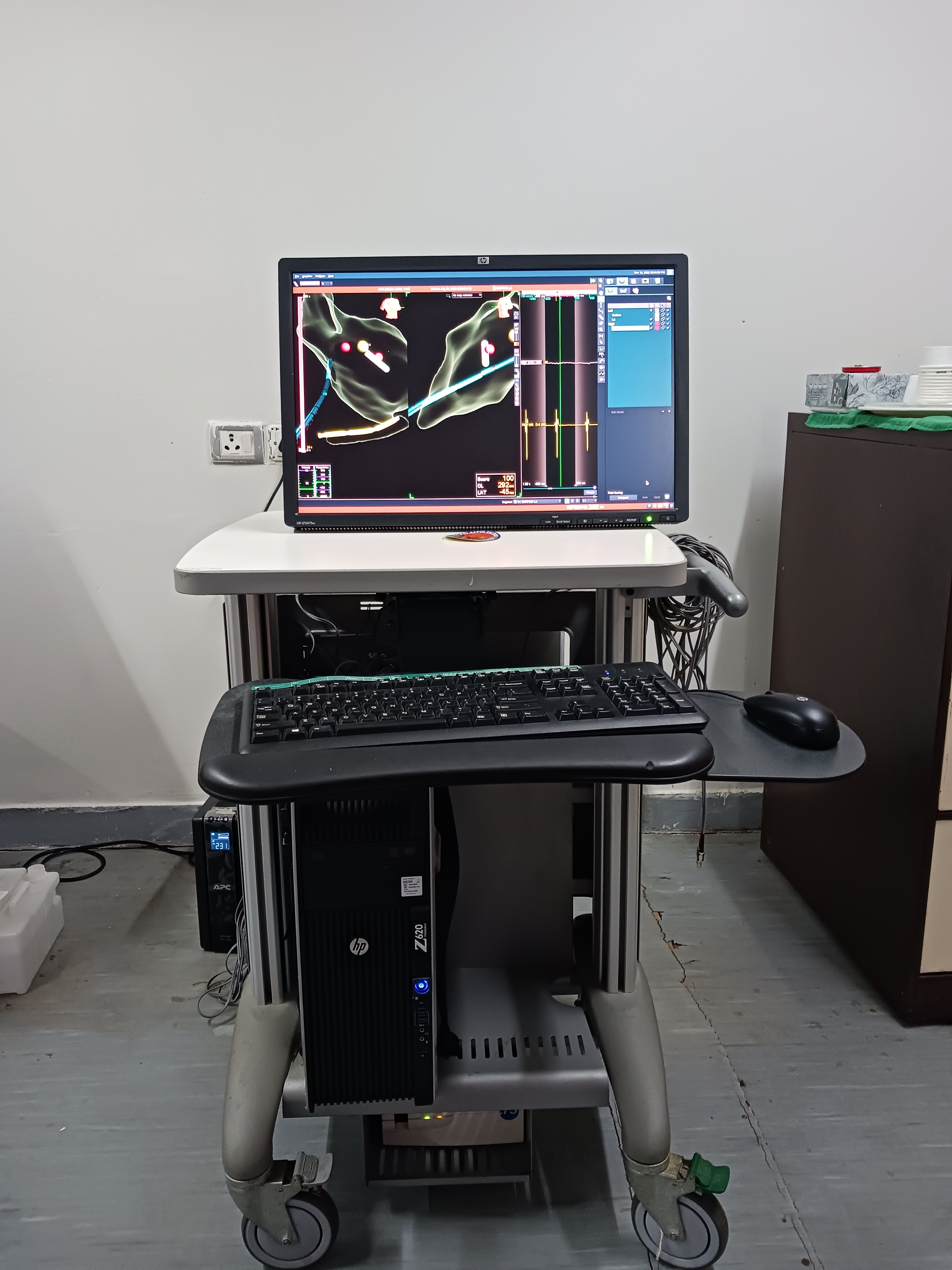 Ensite Precision 3D Mapping System