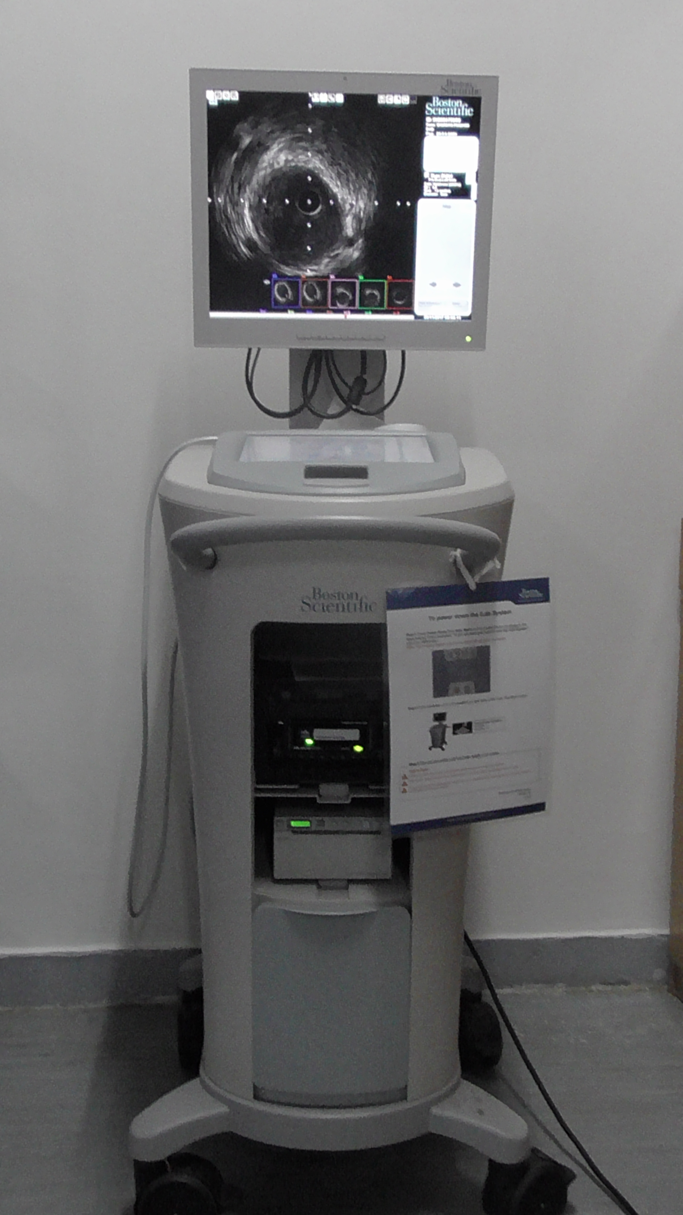 IVUS — Intravascular Ultrasound