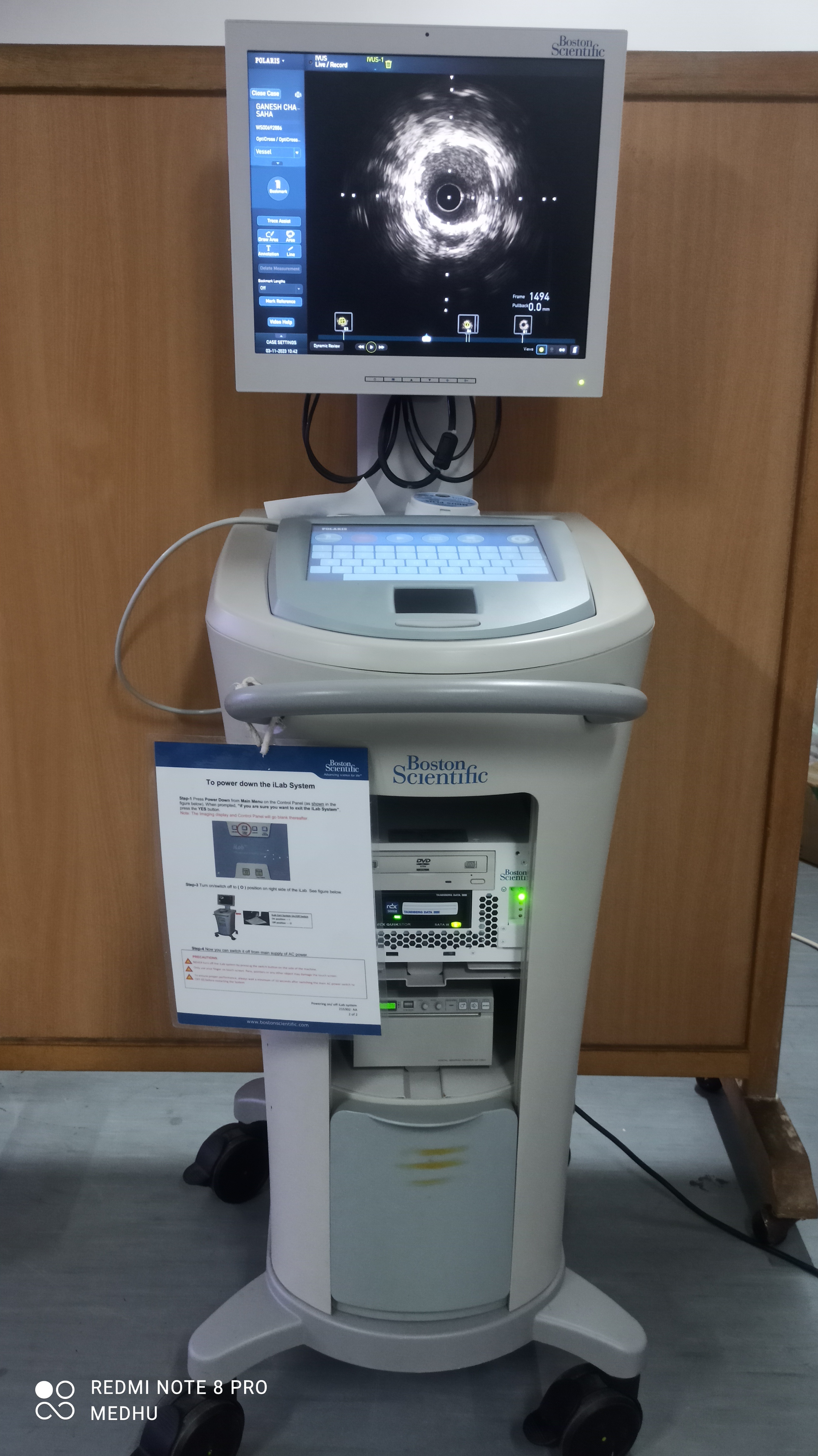 IVUS — Intravascular Ultrasound