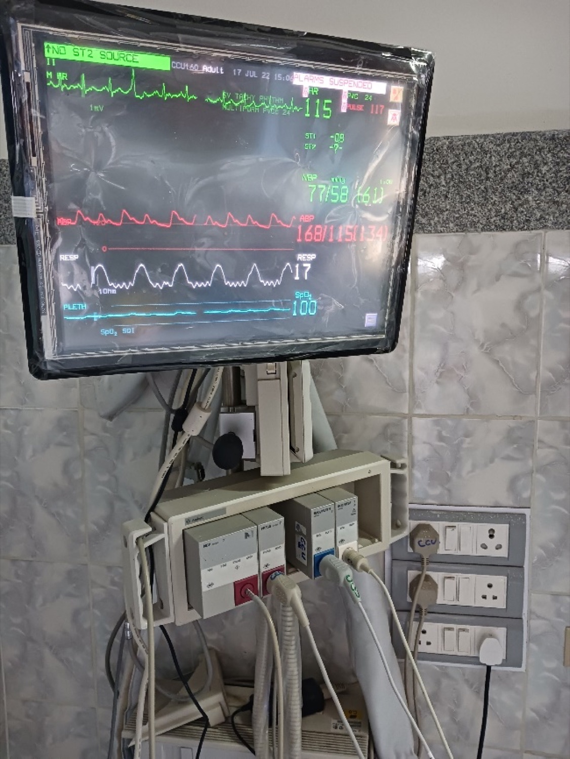Patient monitor in the CCU