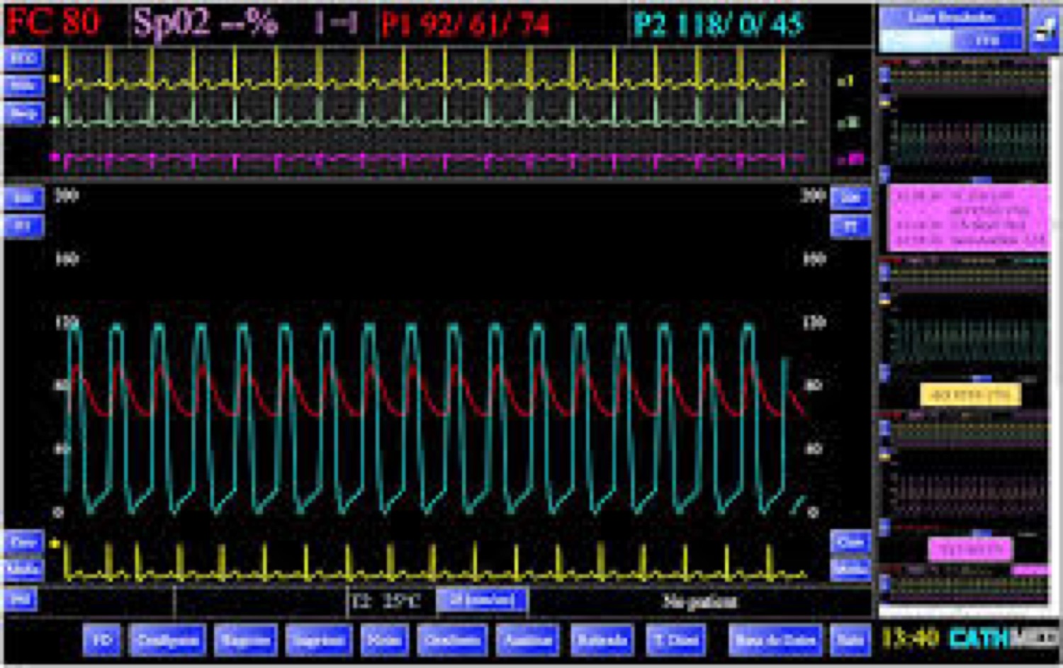 Haemodynamic recording system