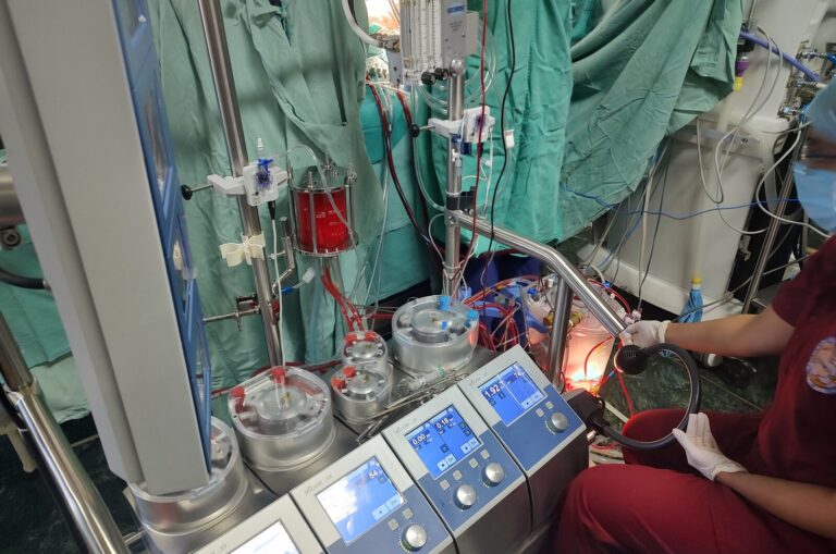 LivaNova Sorin S5 heart-lung machine in use during cardiac surgery